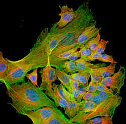 Fluorescence micrograph — osteosarcoma cells: green actin, red microtubules, blue nuclei