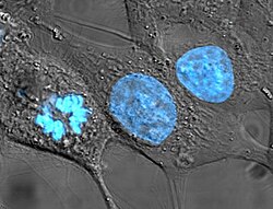 Fluorescence micrograph — HeLa cell nuclei stained blue (Hoechst)