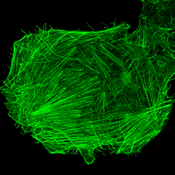 Fluorescence micrograph — actin filament network in a neuroblastoma cell